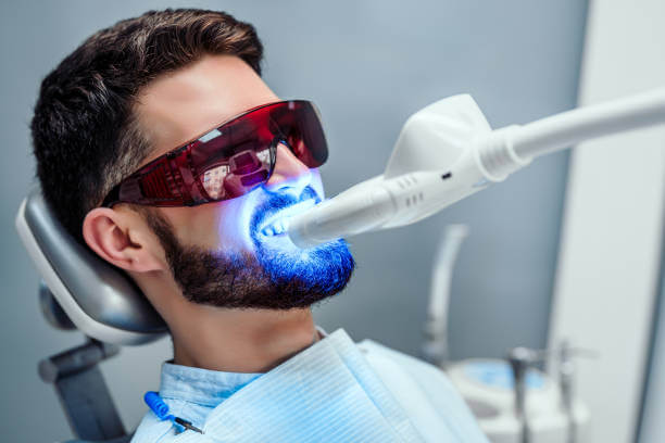professional teeth whitening treatment at 479 Dental Care